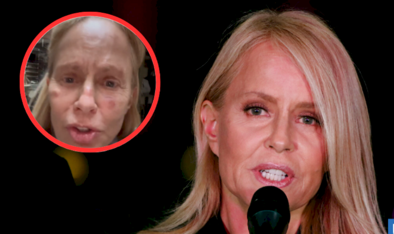 las-impactantes-imagenes-de-como-quedo-cecilia-bolocco-tras-un-tratamiento-facial:-«desfigurada»