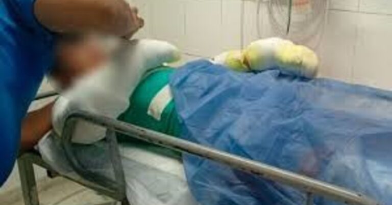 Córdoba: un adolescente está con el 60% del cuerpo quemado después de que le explotó su celular