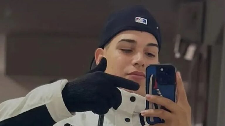 Thiago Medina mostró las cicatrices que le dejó el grave accidente de moto que sufrió en 2025